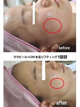 セレブリティ(Celebrity)/ララピール