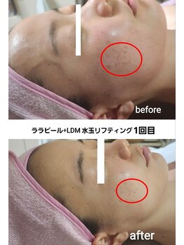 セレブリティ(Celebrity)/ララピール