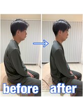 アオ 香椎(AO)/施術前→施術後