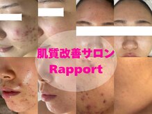 ラポール 金山店(Rapport)