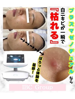 トータルサロンアイビーシー(トータルサロンIBC)/超絶美肌!プラズマゼノデュアル