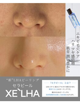 サロン ド アン(Salon de An)/韓国美容最新【セラピール】