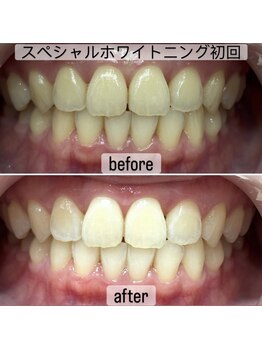 ヤット 森ノ宮(yatto.)/30代女性