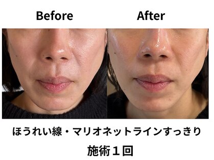 ティアレソワン(tiare soin)の写真