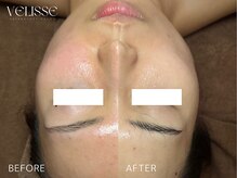 ヴェリス 福岡店(Velisse)/