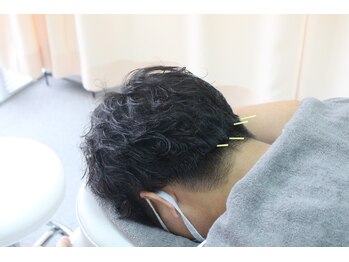 鍼灸院 整骨院ティップ 春日院の写真/腰痛や肩こりをケアしたい方に！ビジネスマンのための鍼灸施術でリセット♪
