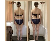 レアフィート(Rheafeet)/1回のビフォーアフターです。