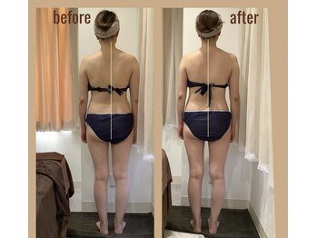 レアフィート(Rheafeet)/1回のビフォーアフターです。