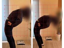 むらた整骨接骨院/腰痛・矯正・骨盤