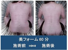 リライム(Relaime)/