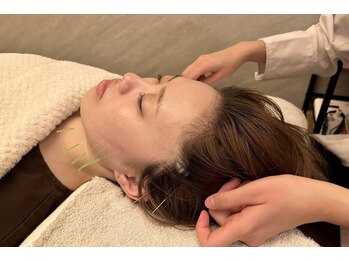 デルタエヌピー63+(δnp63+)/小顔電気鍼[薬院/フェイシャル]