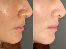 ルーナジェーナ(Luna llena)/池袋　エステ　ルーナジェーナ