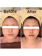 スペチアーレ 夙川/小顔と美肌が手に入り美顔革命