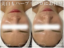 グレイス アンド ミューズ(grace&muse)/【HAAB REPRO】ハーブピーリング