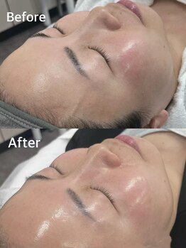 ワミ 八潮(WAMI)/9月ララピールで白肌