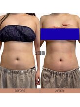 ママニエ(ma maniere)/お腹くびれ美人コース