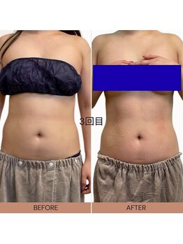 ママニエ(ma maniere)/お腹くびれ美人コース