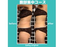 エスティ 浦和店の雰囲気(【腹部集中】ポッコリお腹撃退や代謝UP※クーポン配信中)