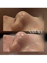 ナチュリー(Natully)/お客様ビフォーアフター