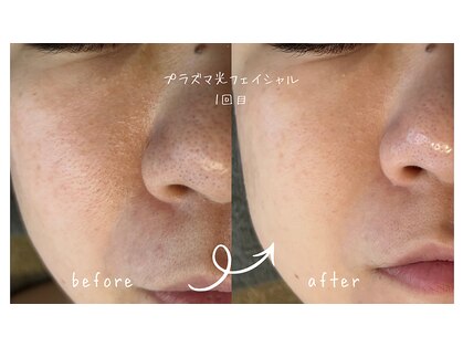 サロン リノ(salon rino)の写真