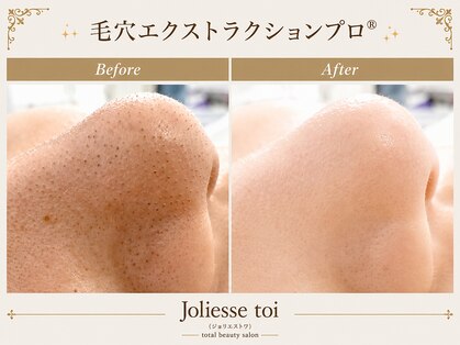 ジョリエストワ(Joliesse toi)の写真