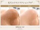 ジョリエストワ(Joliesse toi)の写真