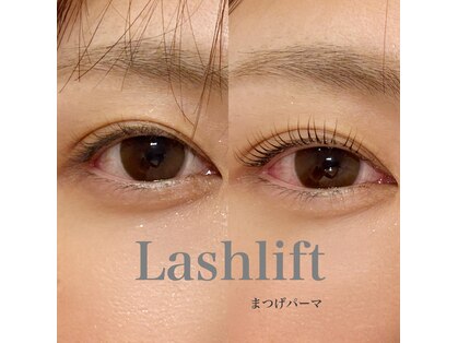 リンダ(LINDA)の写真