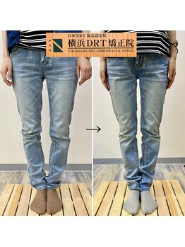 横浜DRT矯正院/O脚矯正