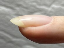 セラキュアネイル(Theracure nail)の雰囲気（フィルインで爪を傷めず、爪1本1本にこだわる美フォルム施術）