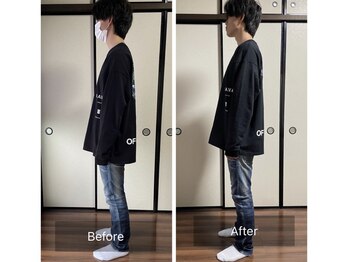 ミントのかべの整体院/姿勢矯正ビフォーアフター