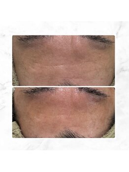 サラン(SALON)/メンズ ビフォーアフター