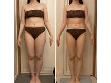 ヴェリティー(Verity)/ビフォーアフター