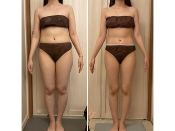 ヴェリティー(Verity)/ビフォーアフター