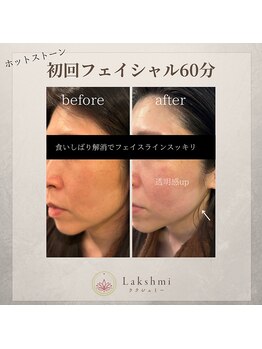 ラクシュミー(Lakshmi)/