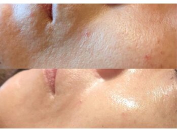 ルアーナ(Luana)/長年の肌悩み改善