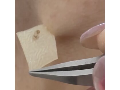 リバース(Re:Birth)の写真