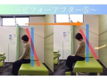 ケアるら整骨院 富里院/ビフォーアフター
