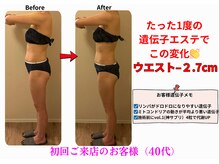 エーシーサロン 六本木店(acsalon)/これぞ遺伝子エステの威力♪