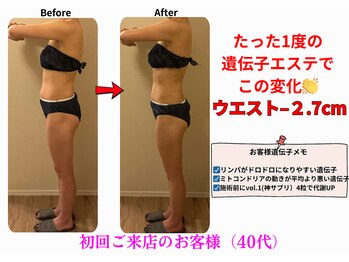 エーシーサロン 六本木店(acsalon)/これぞ遺伝子エステの威力♪