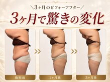 ミチカ(MICHIKA)の雰囲気（どこに行っても痩せられなかった方の最後の駆け込みサロン！）