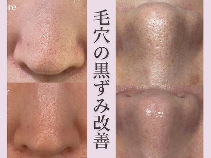 ココリールの写真
