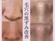 ココリールの写真