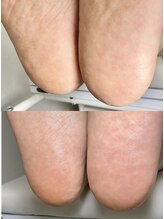 ネイル&アイラッシュ ルミア(Nail & Eyelash LUMIA)/フットケア