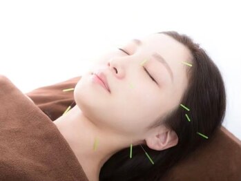 ヘルスケアエイド鍼灸接骨院 蘇我院の写真/セルフエステやセルフケアで中々改善されない方へ！夏の紫外線でダメージを受けたお肌は美容鍼でケアを◎