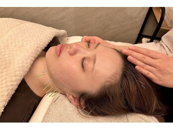 デルタエヌピー63+(δnp63+)/小顔電気鍼[薬院/フェイシャル]