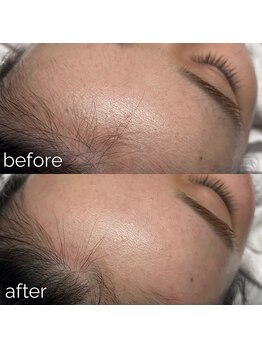 アリシア ビューティーサロン(Alicia)/肌が綺麗になるフェイスワックス