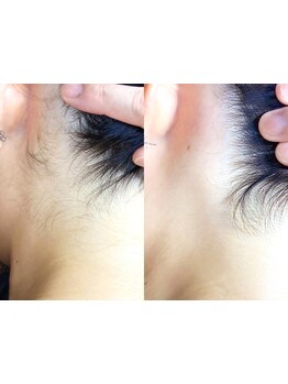 1回ごとにお支払い可能なサロン