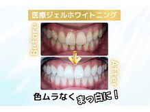 プラチナムビューティ 福山駅前店の雰囲気（想像を超える白さに！あなたの笑顔が際立ちます。）