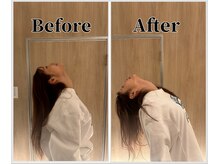 整体ラルース 中目黒(LALUZ)/20代 女性 ストレートネック改善