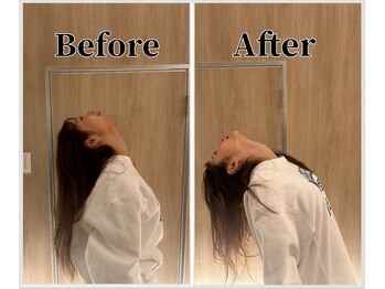 整体ラルース 中目黒(LALUZ)/20代 女性 ストレートネック改善